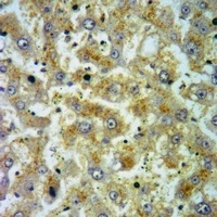 Cerebellin 1 Rabbit Polyclonal Antibody