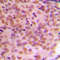 Cyclin B1 (Phospho-S126) Rabbit Polyclonal Antibody