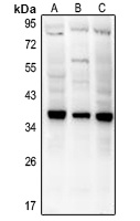 CD154 Antibody