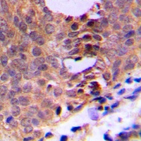 CDC2 (Phospho-T161) Antibody