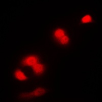CDC2 Rabbit Polyclonal Antibody