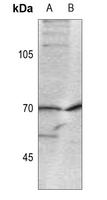 CDC25A (Phospho-S124) Rabbit Polyclonal Antibody
