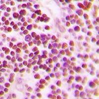 CDC25A (Phospho-S75) Antibody