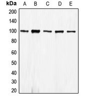 E Cadherin Rabbit Polyclonal Antibody