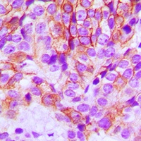 E Cadherin Rabbit Polyclonal Antibody