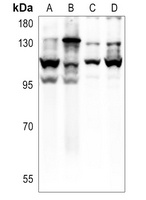 E Cadherin Antibody