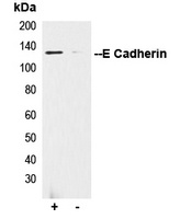 E Cadherin Antibody
