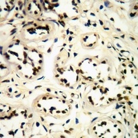 CDK1/2/3 (Phospho-T14) Antibody