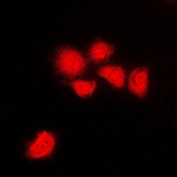 CDK1/2/3 (Phospho-T14) Antibody