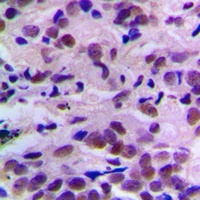 CDK2 (Phospho-T160) Rabbit Polyclonal Antibody