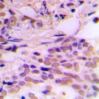 CDK7 Rabbit Polyclonal Antibody