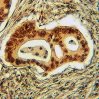 p27 Kip1 (Phospho-T198) Antibody