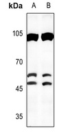 C/EBP beta Antibody