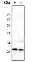 C/EBP delta/epsilon Antibody