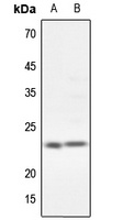 CG beta Rabbit Polyclonal Antibody