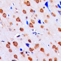 CHK1 (Phospho-S317) Rabbit Polyclonal Antibody