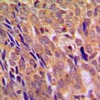 IKK alpha Rabbit Polyclonal Antibody