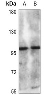 CLCN6 Rabbit Polyclonal Antibody