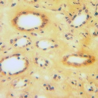 CLCN6 Rabbit Polyclonal Antibody