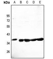 CLNS1A Rabbit Polyclonal Antibody