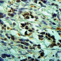 CLNS1A Rabbit Polyclonal Antibody