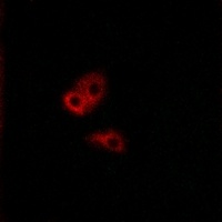 CNGA2 Rabbit Polyclonal Antibody