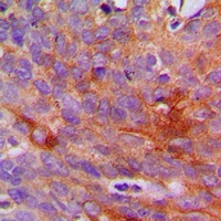 Collagen 1 alpha 2 Antibody