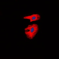 Collagen 1 alpha 2 Antibody