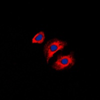 Collagen 3 alpha 1 Antibody