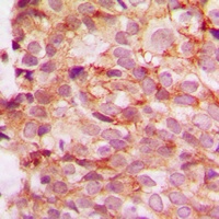 Collagen 4 alpha 1 Antibody
