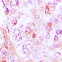 Collagen 6 alpha 2 Antibody