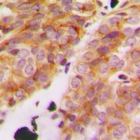 Collagen 11 alpha 1 Antibody