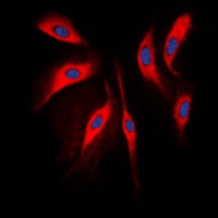COMT Rabbit Polyclonal Antibody
