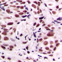 CREB (Phospho-S133) Antibody