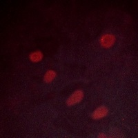 ATF2 (Phospho-S498) Antibody