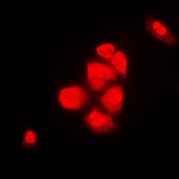 XPO2 Antibody [KO/KD Validated]