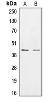 CK1 epsilon Rabbit Polyclonal Antibody