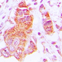 CK1 epsilon Rabbit Polyclonal Antibody