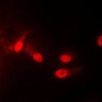 CK1 epsilon Rabbit Polyclonal Antibody