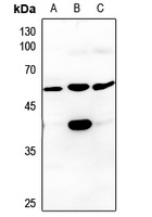 CK1 gamma 3 Rabbit Polyclonal Antibody