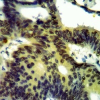 CK1 gamma 3 Rabbit Polyclonal Antibody