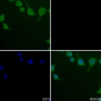 CK1 gamma 3 Rabbit Polyclonal Antibody