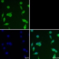 CK2 beta (Phospho-S209) Antibody