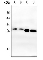 CK2 beta Rabbit Polyclonal Antibody