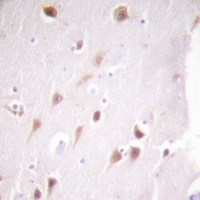 CK2 beta Rabbit Polyclonal Antibody