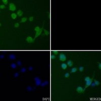 CK2 beta Rabbit Polyclonal Antibody