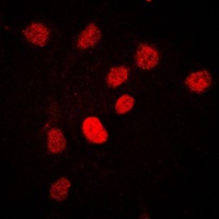 CstF-64 Rabbit Polyclonal Antibody