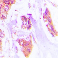 Cardiotrophin-1 Antibody
