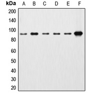 Beta-catenin Rabbit Polyclonal Antibody