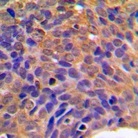 Beta-catenin Rabbit Polyclonal Antibody